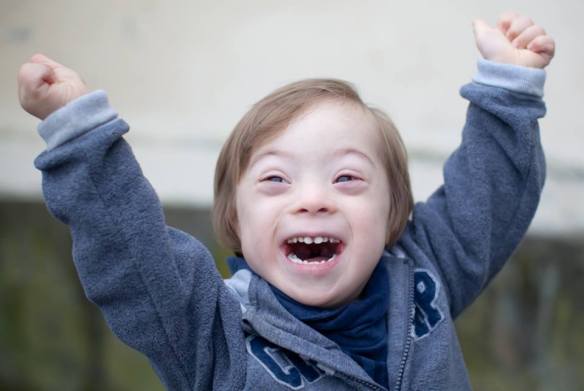 Foto: Kleiner Junge mit Trisomie 21 freut sich